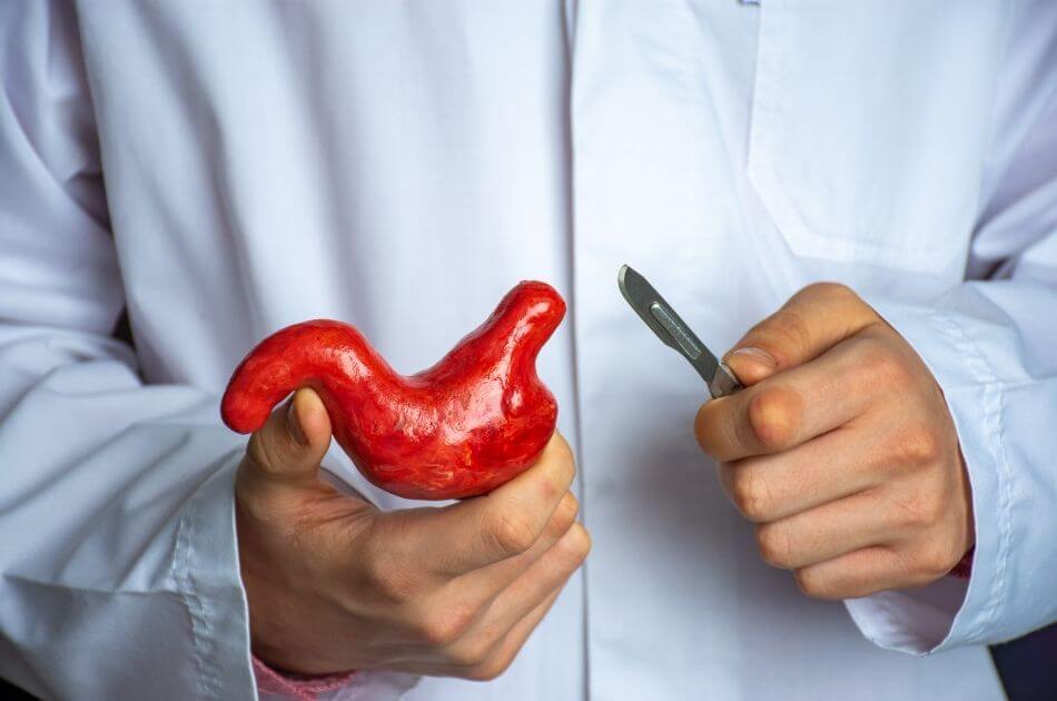 How to Stay Organized Before and After Bariatric Surgery